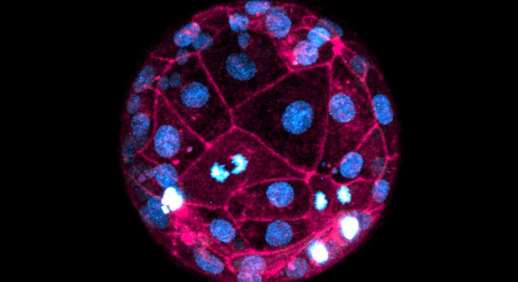 A human embryo using pink and blue dyes