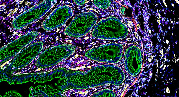An image coloured to highlight different cells in the intenstine