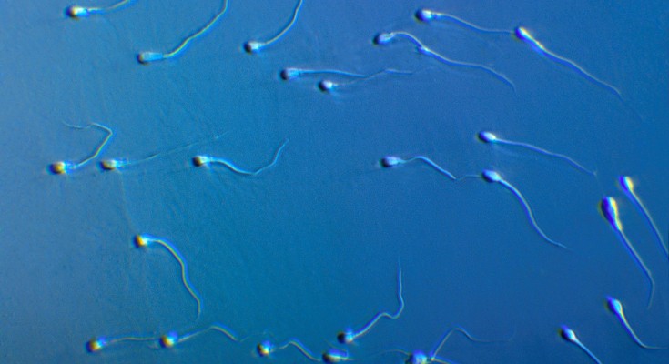 Light micrograph of a field of human sperm with a blue background