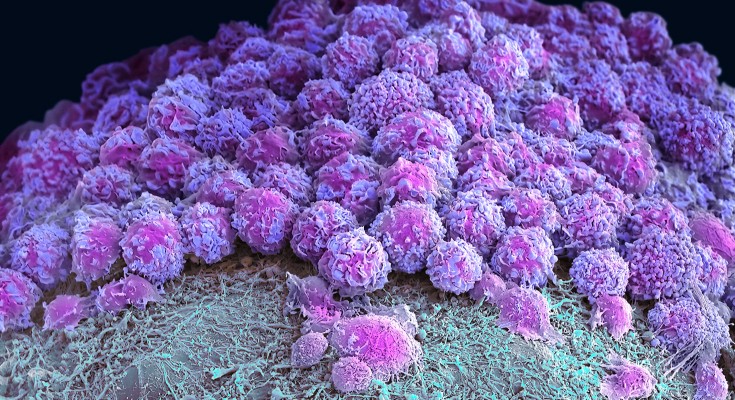 Coloured scanning electron micrograph (SEM) of a neural organoid