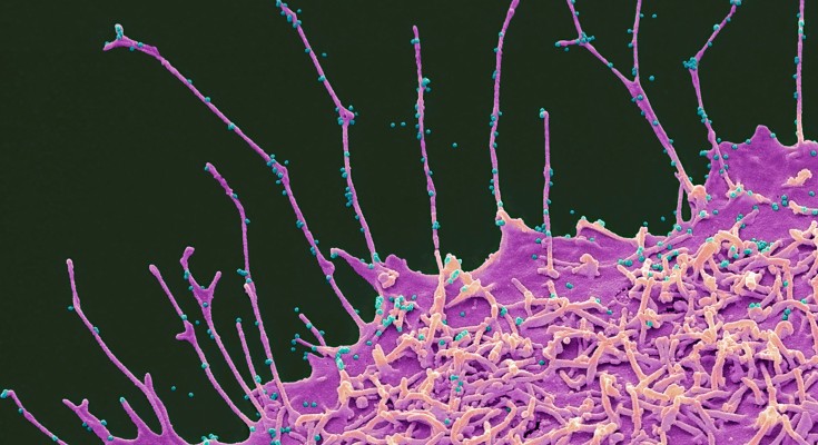 Microscope image of SARS-CoV-2 particles coloured pink and blue