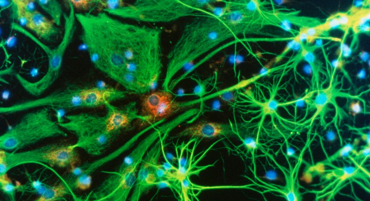 Immunofluorescent light micrograph of stringy-looking green brain cells, containing blue and red dots on a black background