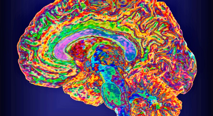 An artificially coloured image of a brain 