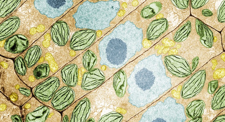 Coloured transmission electron micrograph of duckweed (Spirodela oligorrhiza) root cells, showing cell walls, centralized nuclei and numerous chloroplasts