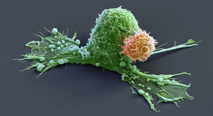 Image of an orange CAR-T cell attacking a green cancer cell