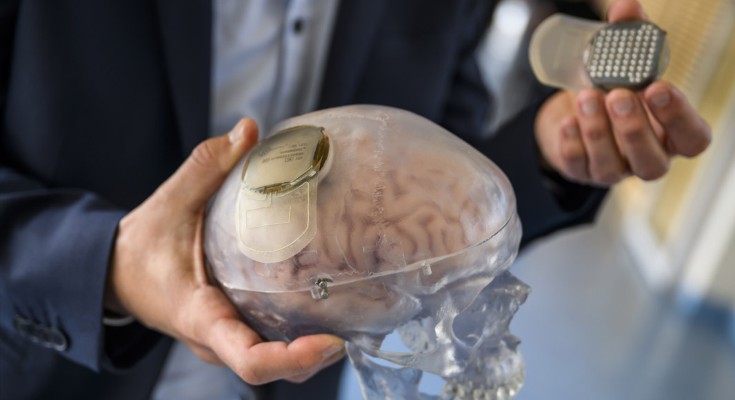 A photograph of a transparent human skull with brain visible inside. There's an electronic device attached to the brain