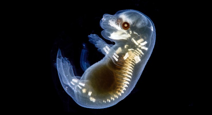 A light micrograph of a mouse embryo