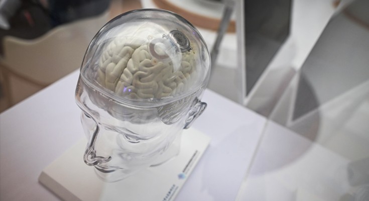 A plastic transparent model of a human head, with brain visible inside. There is a computer device in the brain