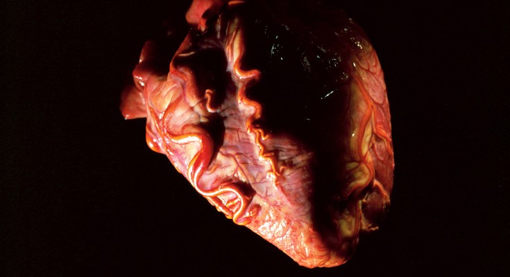 An image of a human heart