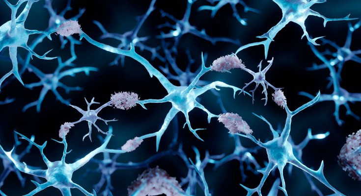 An illustration of amyloid plaques on a black background