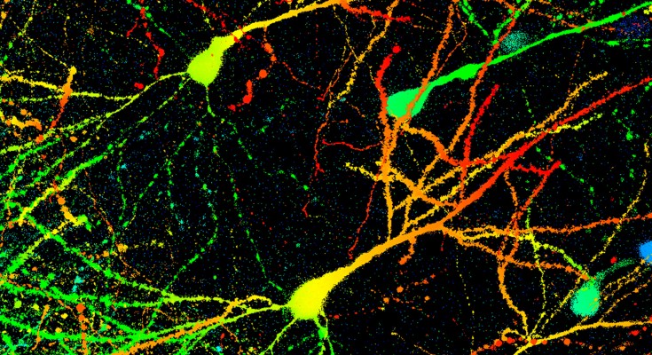 Light micrograph of multicoloured neurons from a mouse brain on a black background