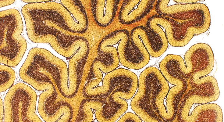 A light micrograph of a cerebellum cross‑section showing tightly folded, branching layers in yellow and brown colours