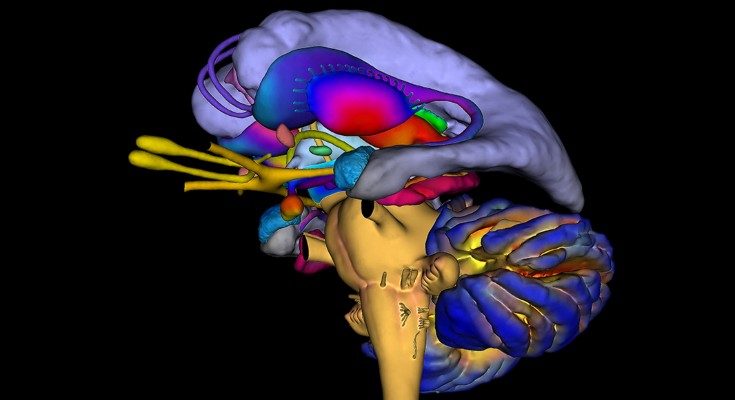 Coloured 3D magnetic resonance imaging (MRI) scan of the human brain with the cerebral cortex removed.