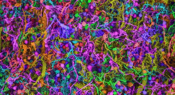 Scanning electron micrograph (SEM) of human brain cells, depicting a complex, intertwined network resembling multicolored spherical structures connected by filament-like strands