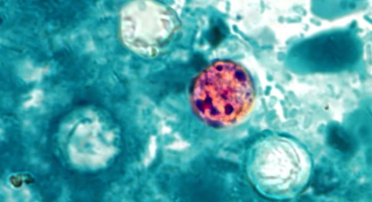 A photomicrograph showing a round, pink-orange stained Cyclospora cayetanensis oocyst with several dark purple spots at its centre, surrounded by three other pale green Cyclospora cayetanensis oocysts against a blue-green background