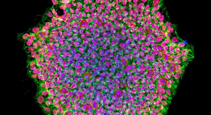 A confocal light micrograph showing the colourful clustered mass of a human-induced pluripotent stem cell (iPSC) colony