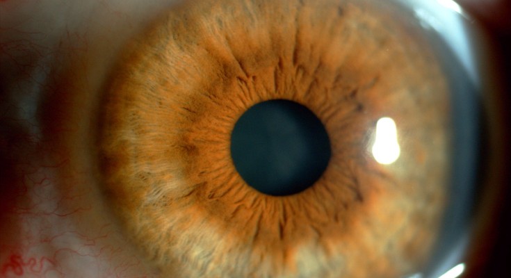 A close-up photograph of an eye