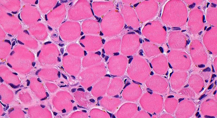 Light micrograph of skeletal muscle cells showing cytoplasm and nuclei
