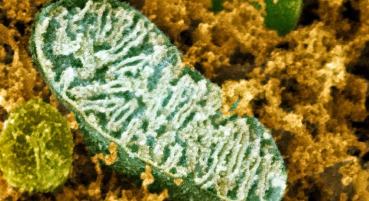 Coloured scanning electron micrograph of a mitochondrion in a nerve cell, showing the wiggly cristrae inside