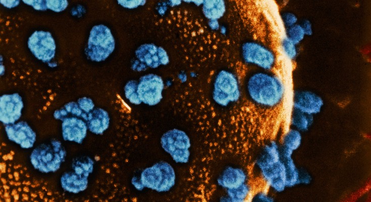 Coloured scanning electron micrograph (SEM) of a cell in an islet of Langerhans from the pancreas