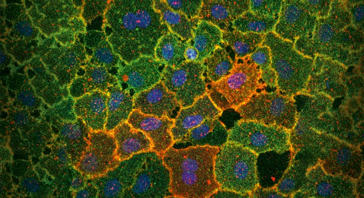 Extracellular vesicles from semen (red) binding to Axl (green), a broadly expressed phosphatidylserine-binding receptor