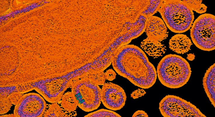 organge splotches that show a visualization of toxin released from bacterial cells