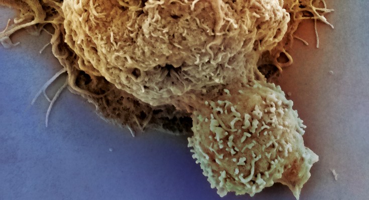 Cancer and immune cellls