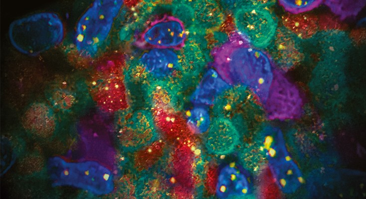Cells in bright fuschia, green red and blue