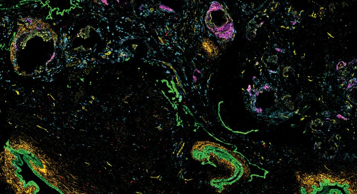 Image of cells in magenta, aqua, yellow and green against a black background