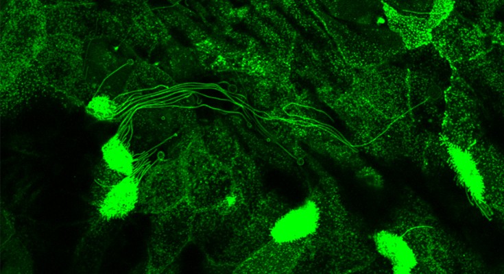 Image of cells and migrasomes in green