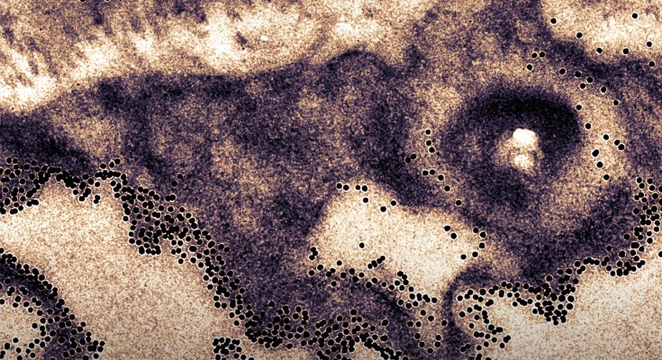 An optical microscopy image of nanoparticles exiting a tumour.