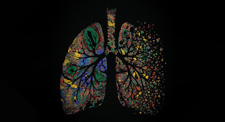 lungs with fluorescent gene expression patterns