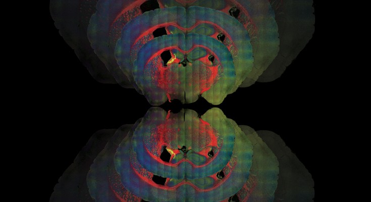 hyperspectral stimulated Raman scattering image of mouse brain