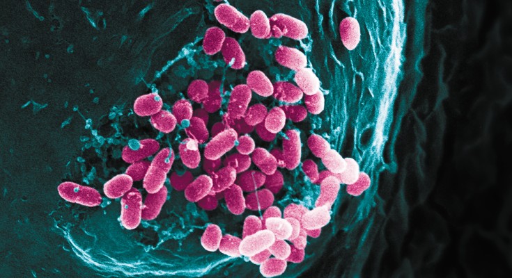 Bacteria fluxing out of an infected cell.