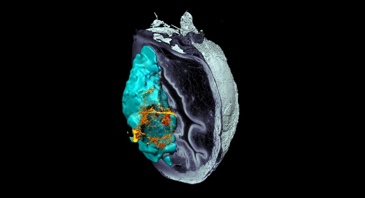The cover image shows a 3D reconstruction of a mouse bladder affected by a prominent tumor, with urease-powered nanobots targeting the tumor.