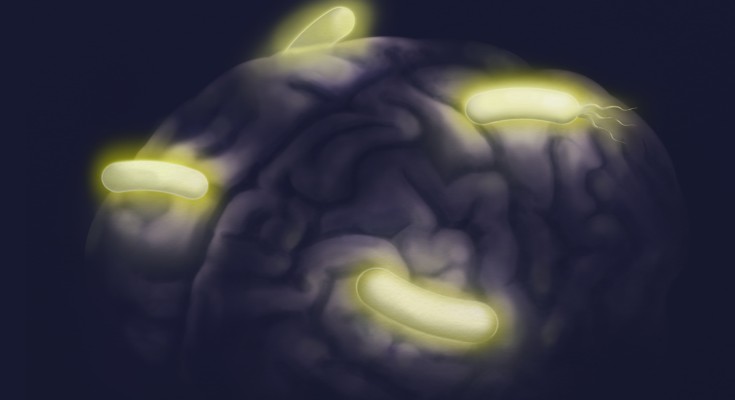Brain with bacteria 
