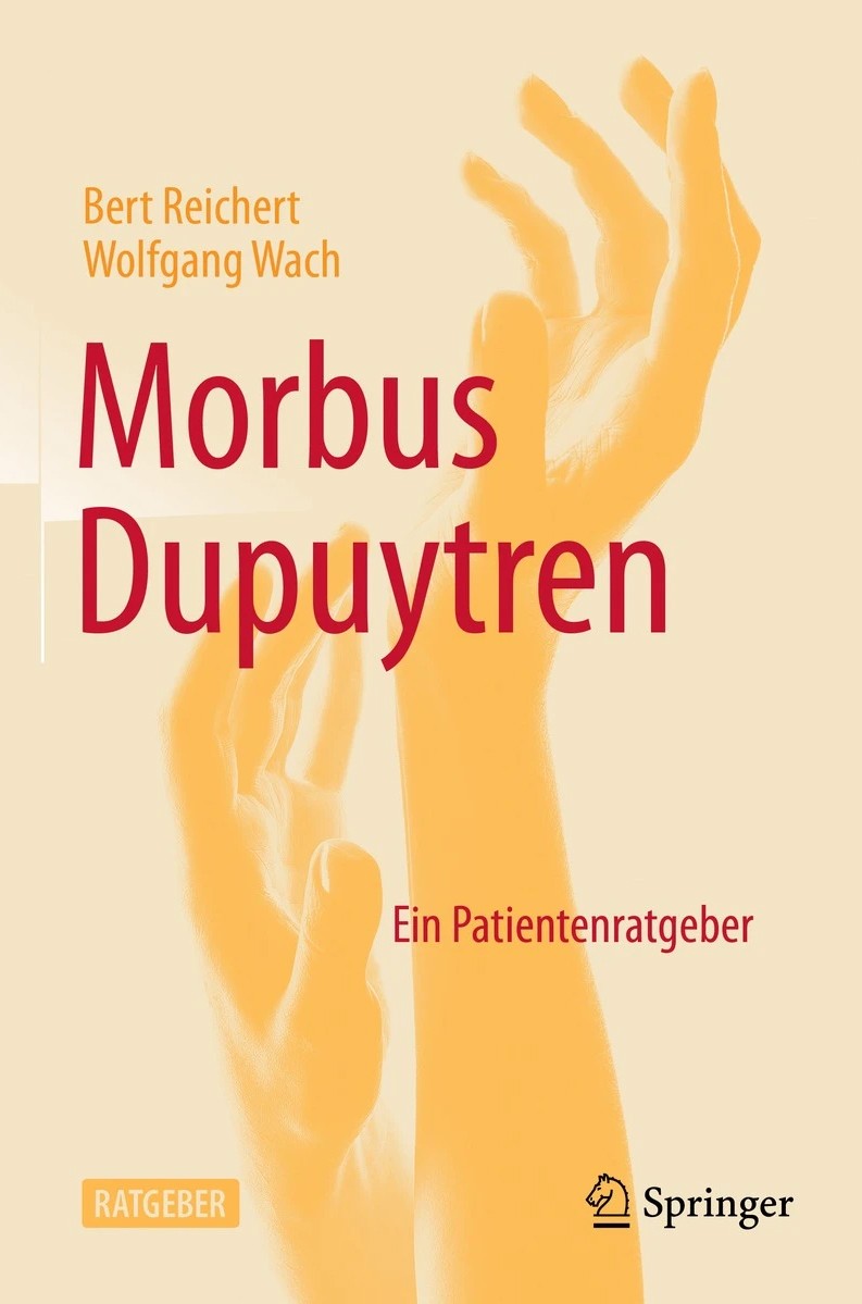 Morbus Dupuytren