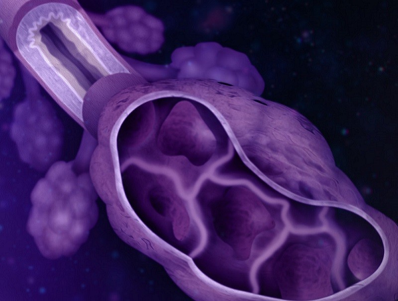 Illustration of an alveoli 