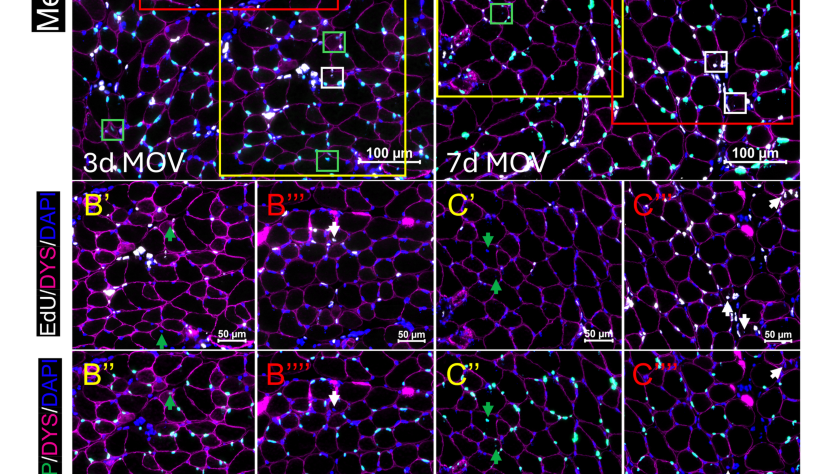 Displaced myonuclei are attributable to both resident myonuclear migration and stem cell fusion during mechanical loading in adult skeletal muscl&hellip;