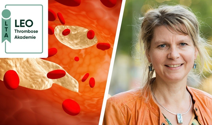 Thrombosemanagement auf einen Blick: Patienten richtig einschätzen und aufklären