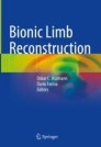 literature review on needs of upper limb prosthesis users Book cover