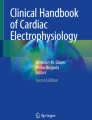 Ventricular Tachycardia | Springer Nature Link