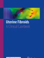 case study on fibroid uterus