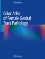 Benign Lesions of the Fallopian Tube | Springer Nature Link