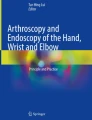 From diagnosis to rehabilitation of trigger finger: a narrative review ...