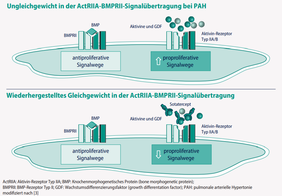 Abbildung MSD Winrevair